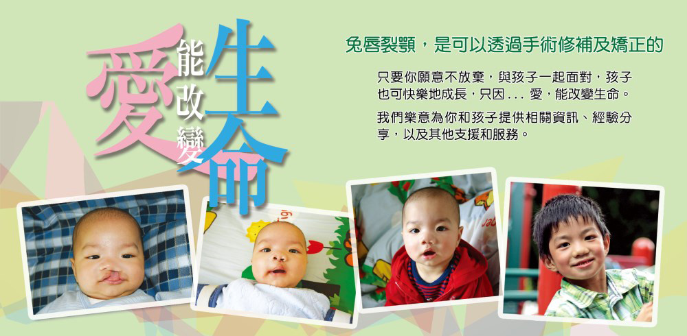 https://www.cleftlip.org.hk/wp-content/uploads/2020/06/banner1.jpg