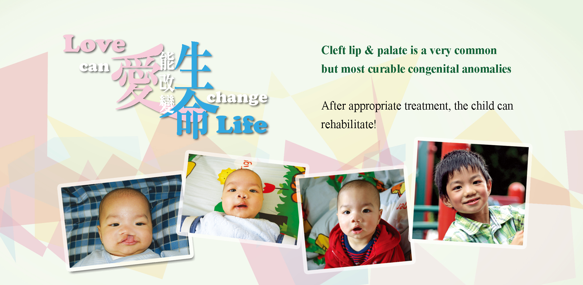 https://www.cleftlip.org.hk/wp-content/uploads/2020/07/20200709_banner_desktop2-copy.jpg