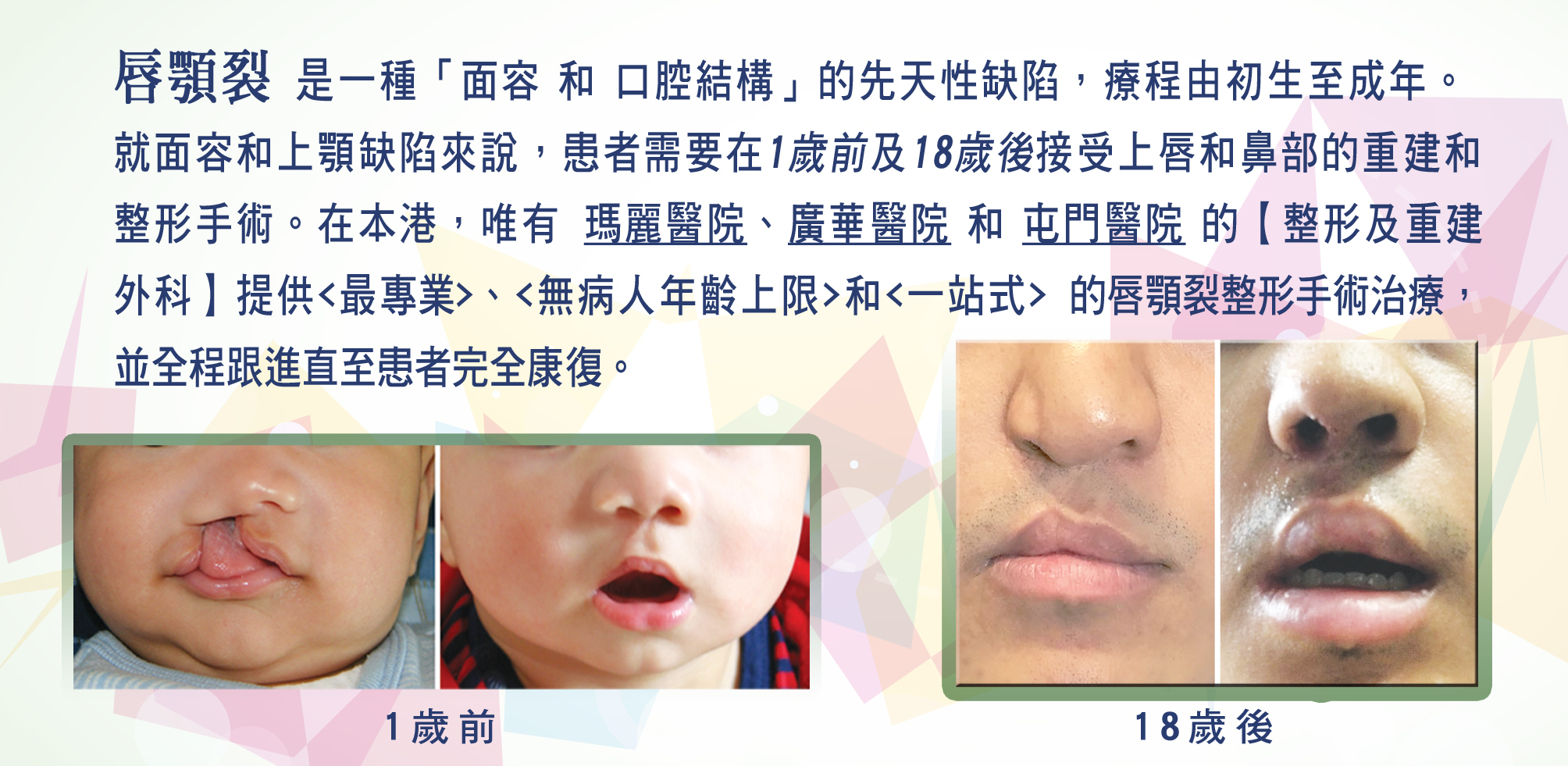 https://www.cleftlip.org.hk/wp-content/uploads/2025/12/2_Different-stage-of-plastic-surgeries-copy.jpg